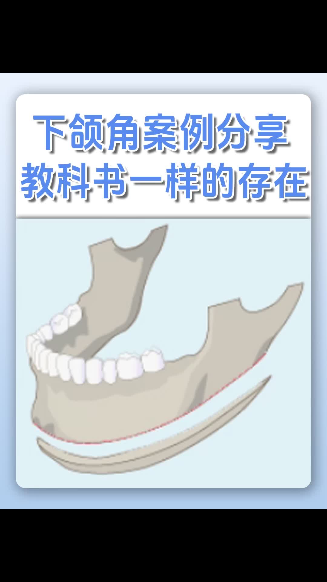 【口腔颌面医生肖林】我的最新作品,快来一睹为快!哔哩哔哩bilibili