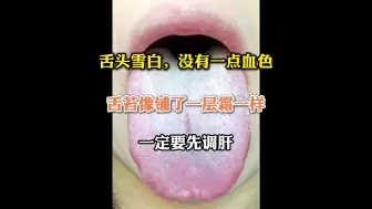 Download Video: 舌头雪白，没有一点血色，舌苔像铺了一层霜一样！一定要先调肝！