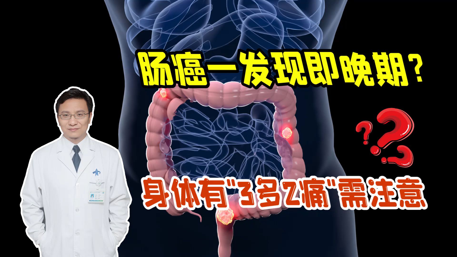 肠癌一发现就是晚期?身体若出现“3多2痛”,尽早检查下肠道哔哩哔哩bilibili