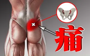 Tải video: 腰骶部屁股经常疼痛，3个动作就能缓解，含自查测试