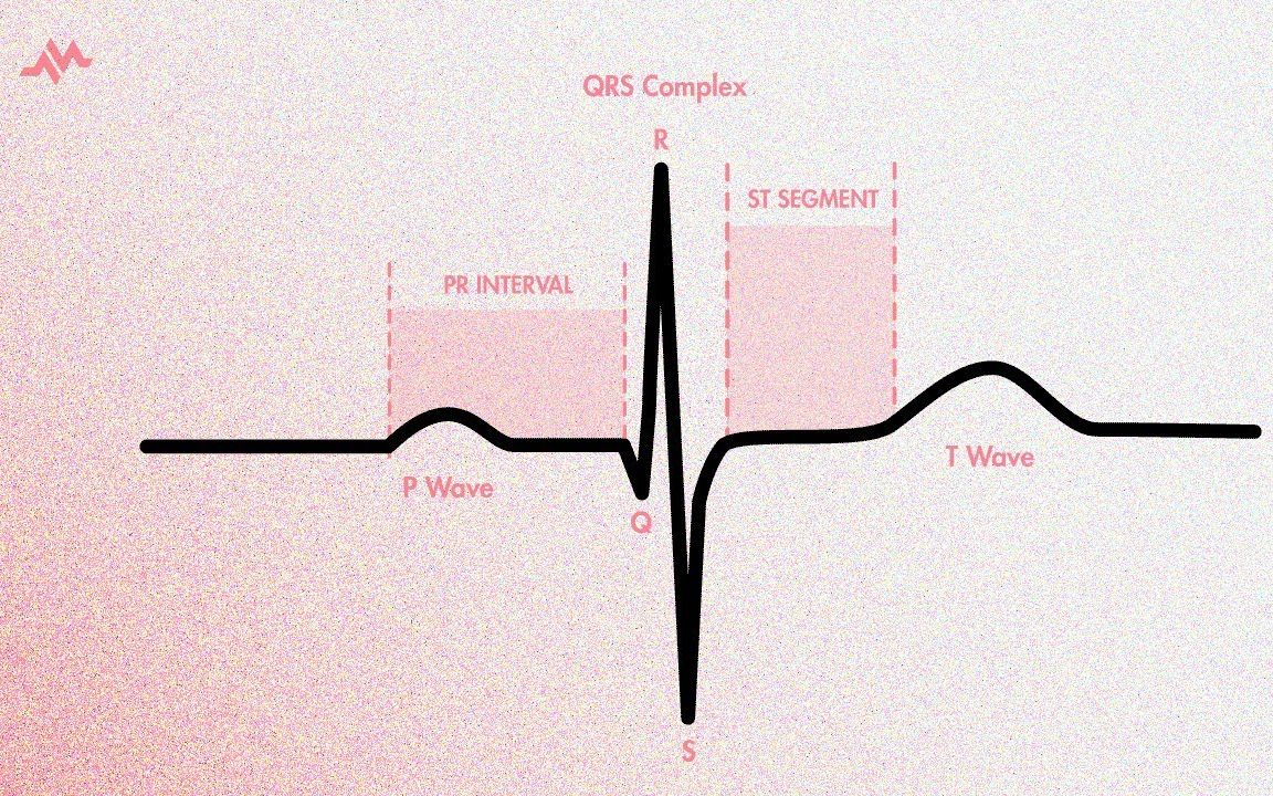 心电图上的心动周期(PQRST波)| 双语字幕哔哩哔哩bilibili