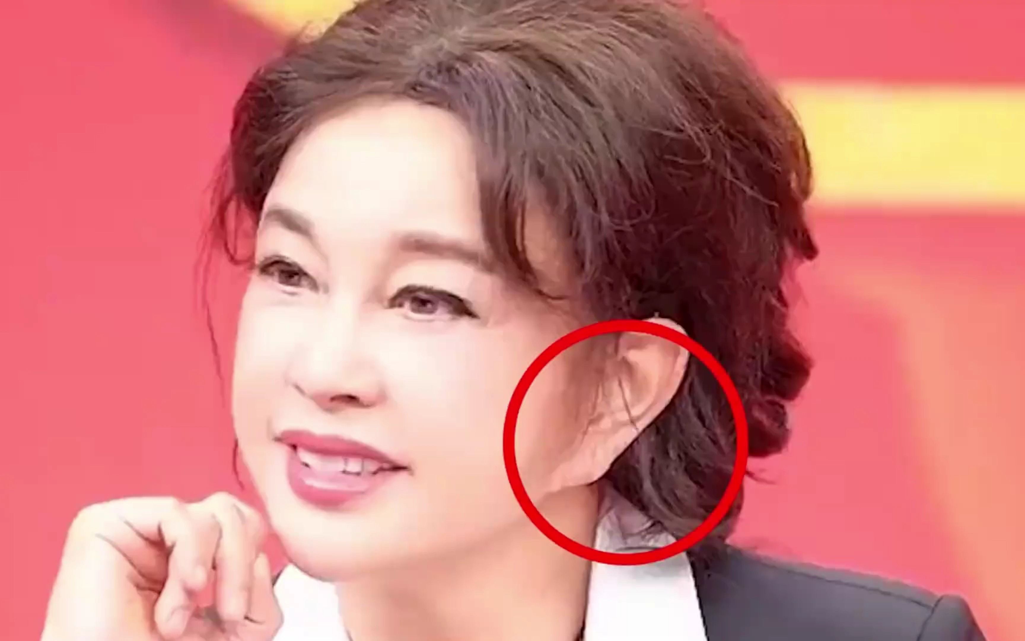 被"医美"坑惨的女星,萧亚轩被嘲格格巫,刘晓庆"玻尿酸"明显