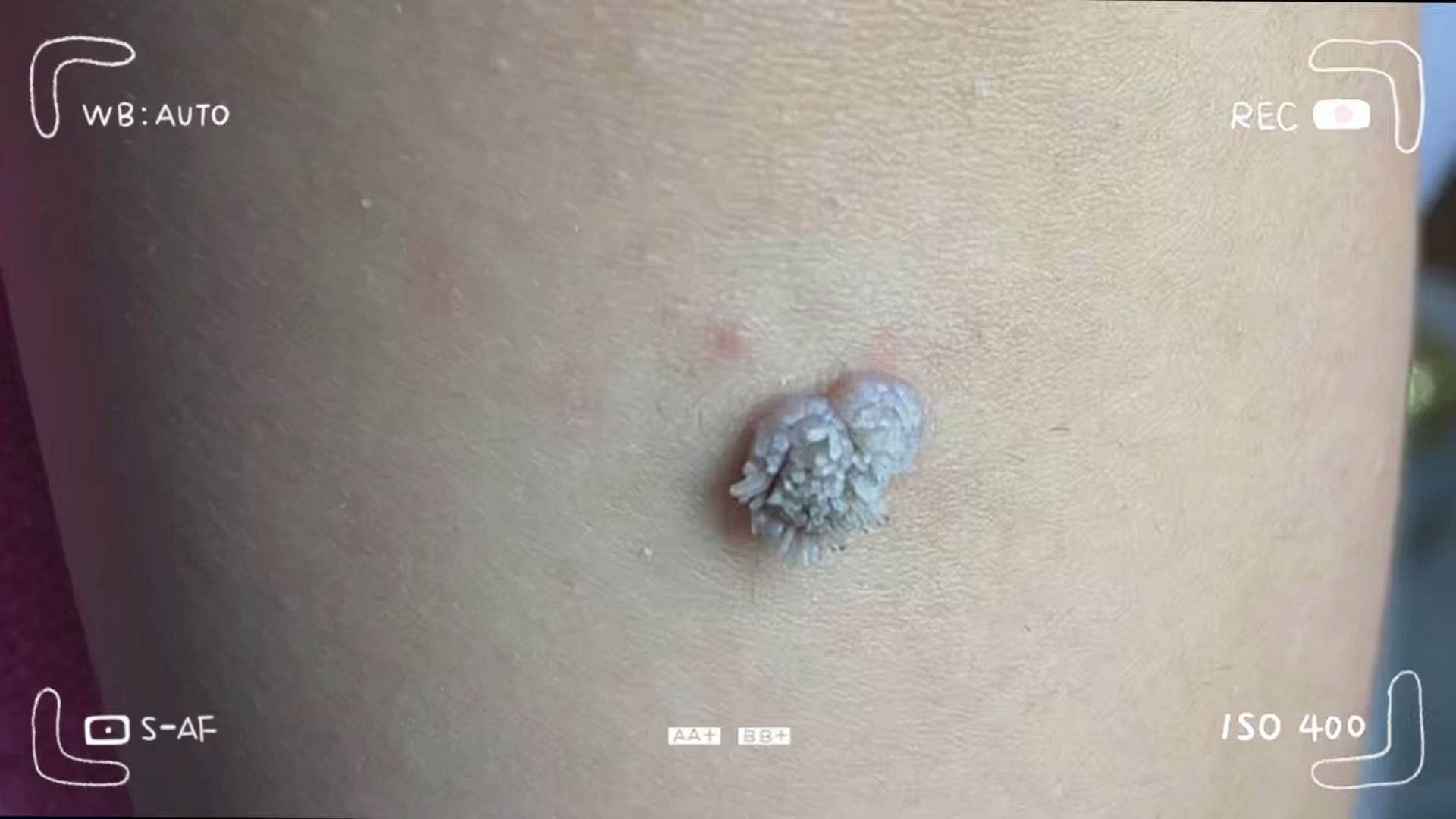 解压,清理瘊子,和菜花一样