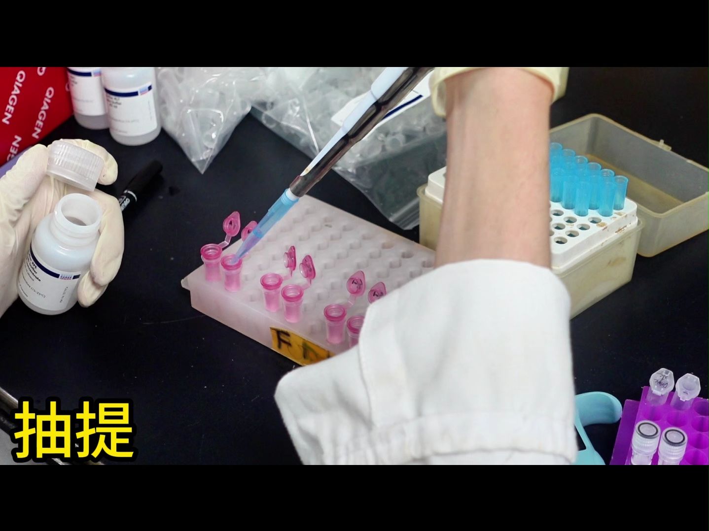 RNA Extraction Kit Comparative Evaluation Test