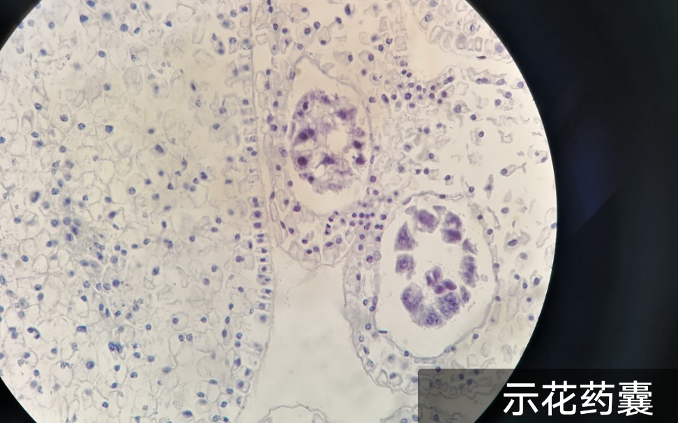石蜡切片包埋王老师上课时学生随手拍