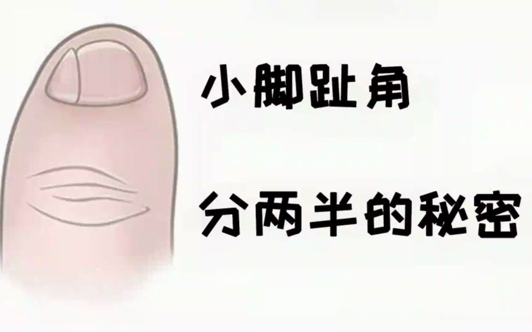 为什么有的人小脚趾甲分两半?是纯种汉族人?