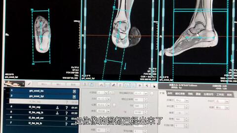磁共振扫描】联影1.5T踝关节MRI扫描技术（仅供参考）_哔哩哔哩_bilibili
