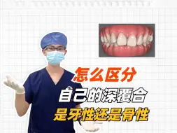 Download Video: 深覆合如何区分牙性or骨性？