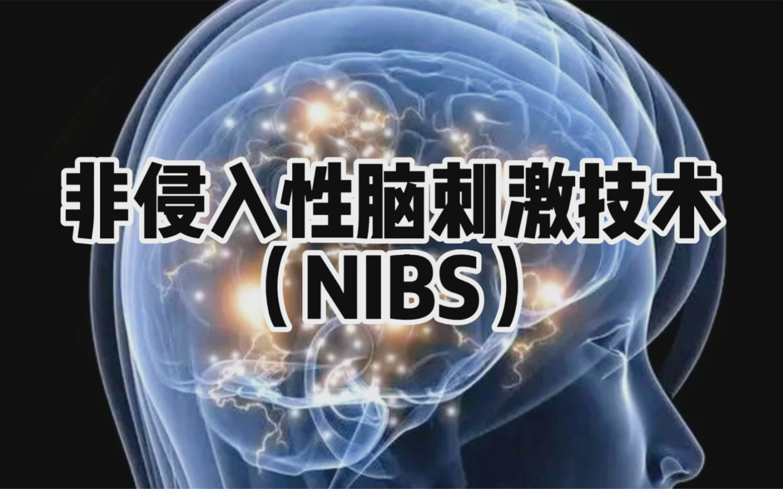 非侵入性脑刺激技术可应用于多种疾病!主要有经颅磁刺激治疗和经颅直流电治疗哔哩哔哩bilibili