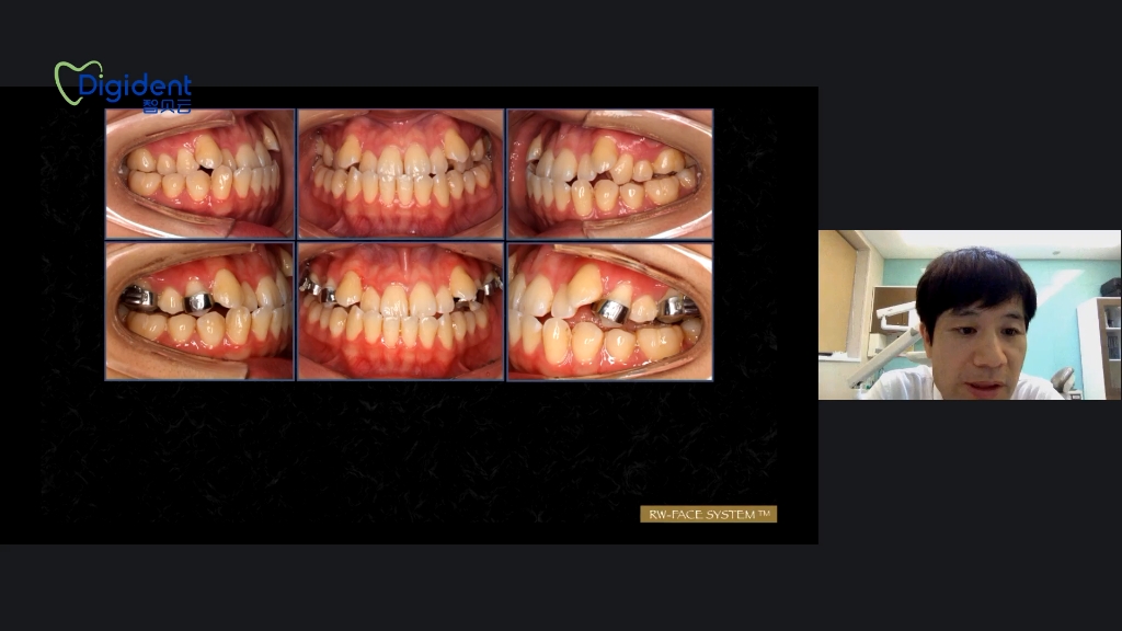 [图]RW-FACE整体正畸学系列课（共5讲）