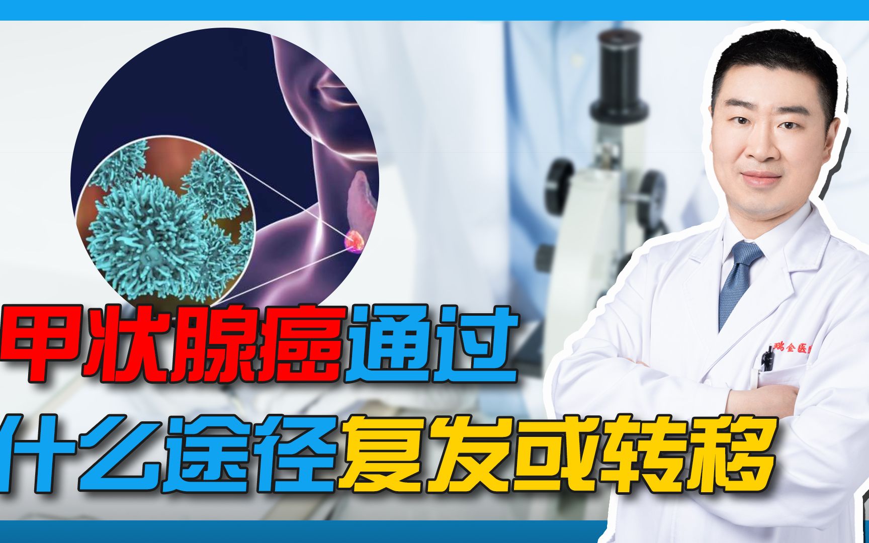 甲状腺癌手术以后,甲状腺癌会复发或者转移吗?都有哪些途径?哔哩哔哩bilibili