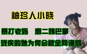 Download Video: 被讽“网络大孝子”,从被可怜到耗子二姑,袖珍小晓究竟做错了啥？