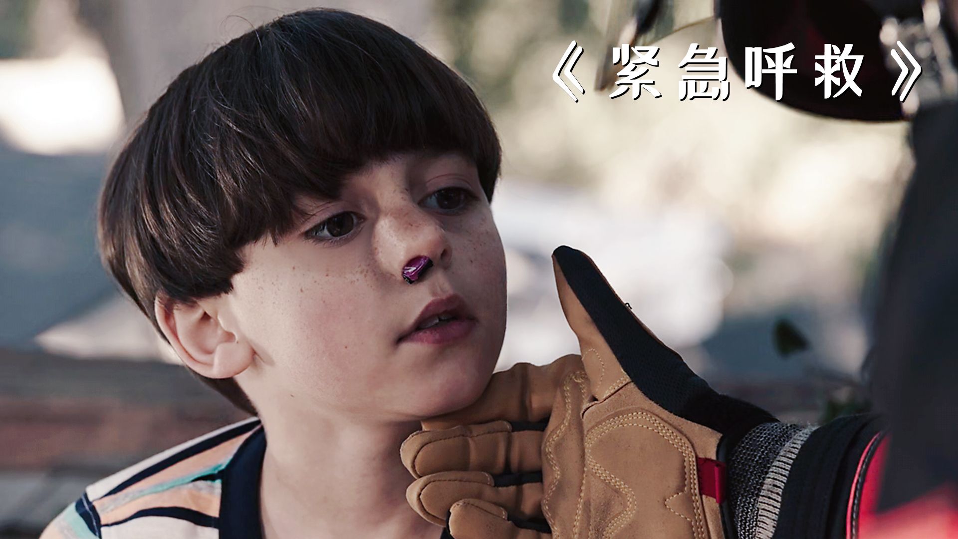 男孩把玩具车塞进了鼻子,原因让人哭笑不得!《紧急呼救》