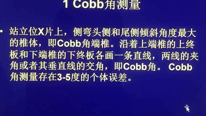 脊柱侧弯Cobb角测量哔哩哔哩bilibili