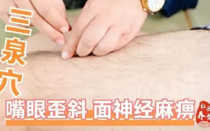 Video herunterladen: 刘红云讲董氏针灸：三泉穴针法；嘴歪眼斜，面部神经麻痹特效穴