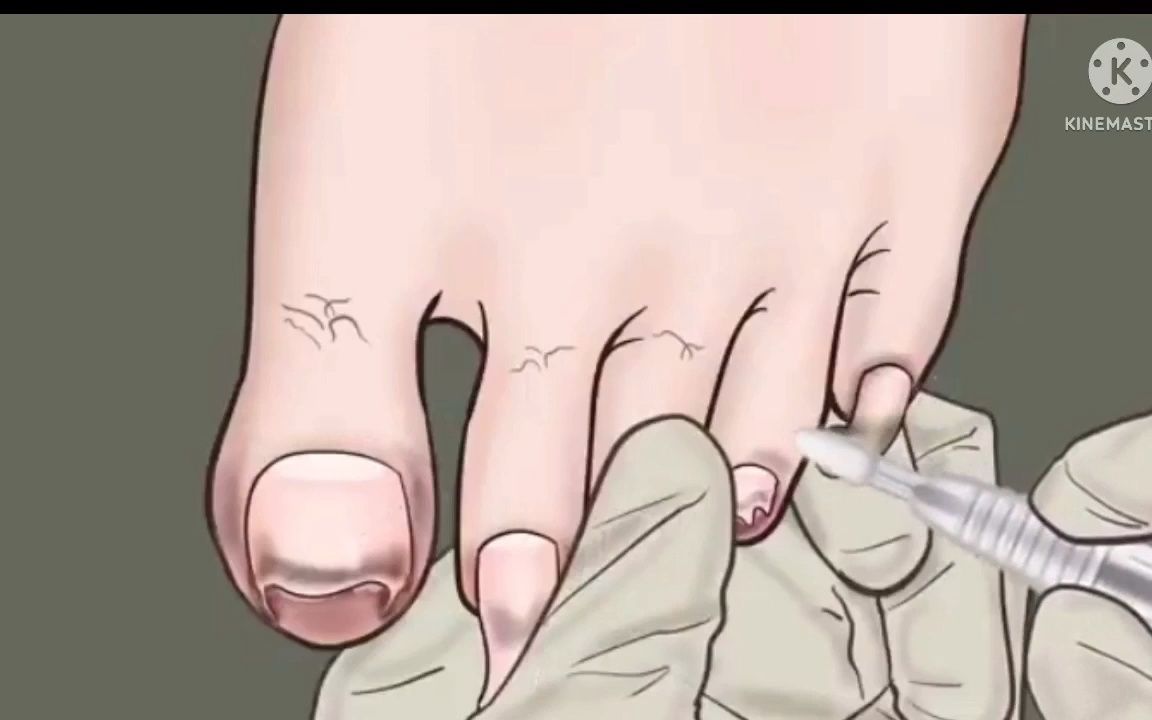 【沉浸式修脚】如何修脚清洁指甲 解压修脚动画