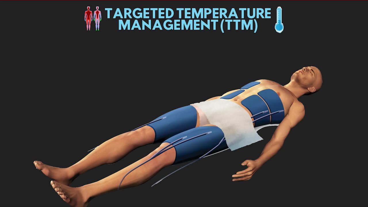 [图]复苏后体温管理Targeted Temperature Management (TTM)