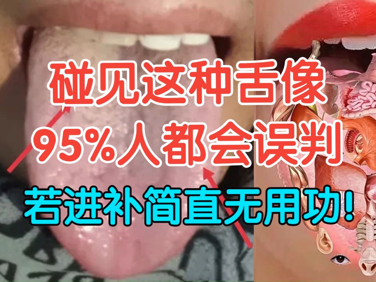 这种舌头,95%人认为气血两虚、湿气重,若进补简直无用功!哔哩哔哩bilibili