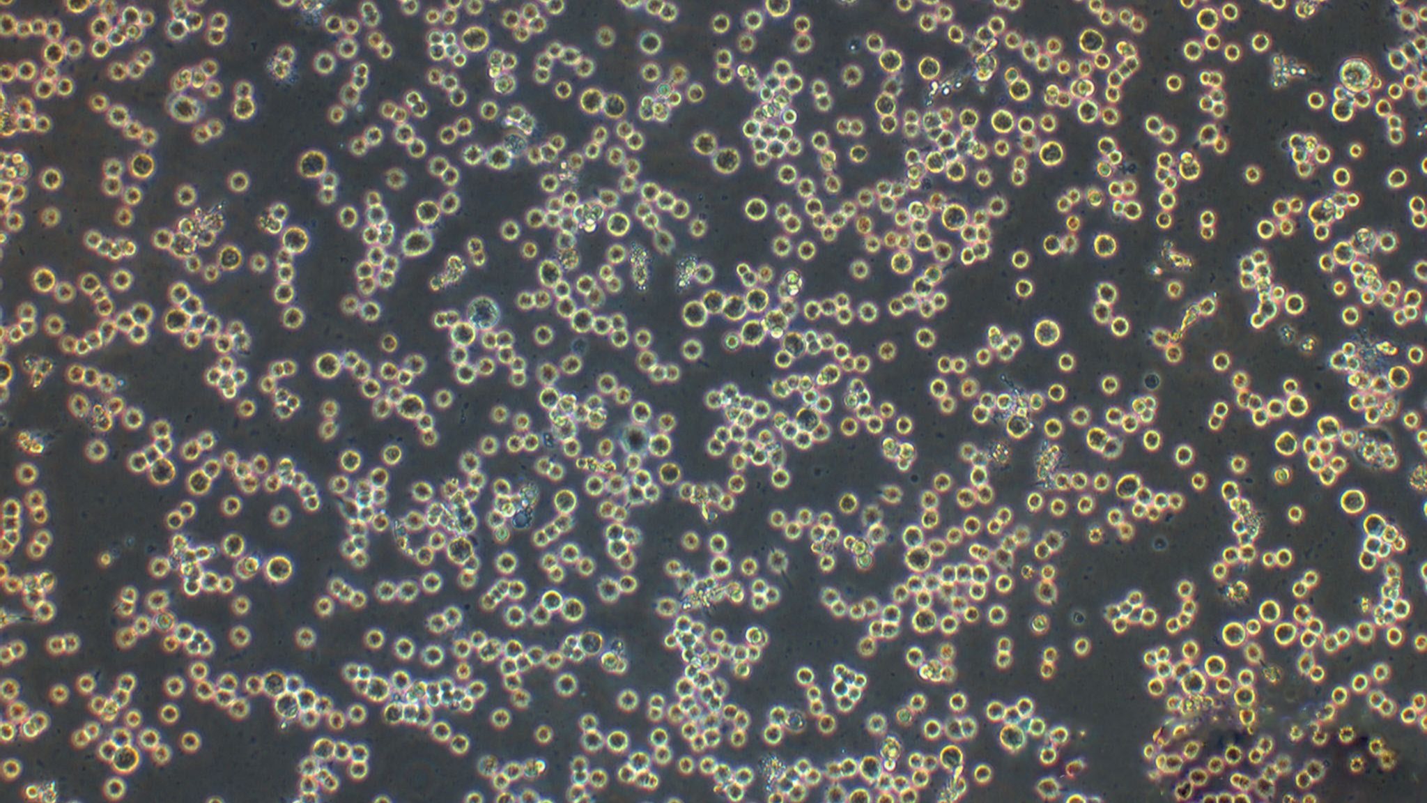 pbmc细胞,pbmc细胞冻存液 pbmc细胞,pbmc细胞冻存液
