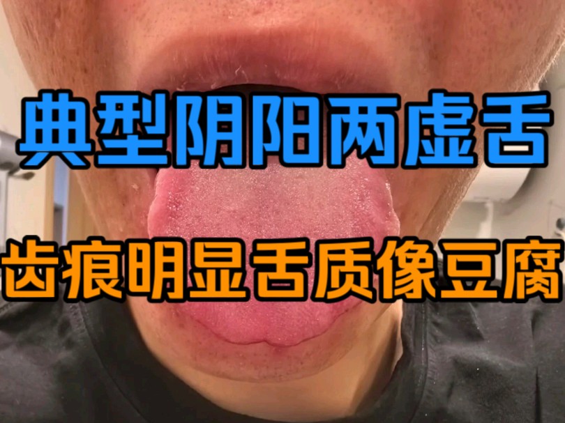 阴阳两虚的症状图片