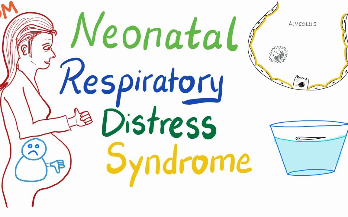 新生儿呼吸窘迫综合征Neonatal Respiratory Distress Syndrome (NRDS)哔哩哔哩bilibili