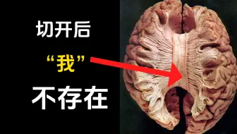 人类意识令人不安的真相 | 裂脑实验