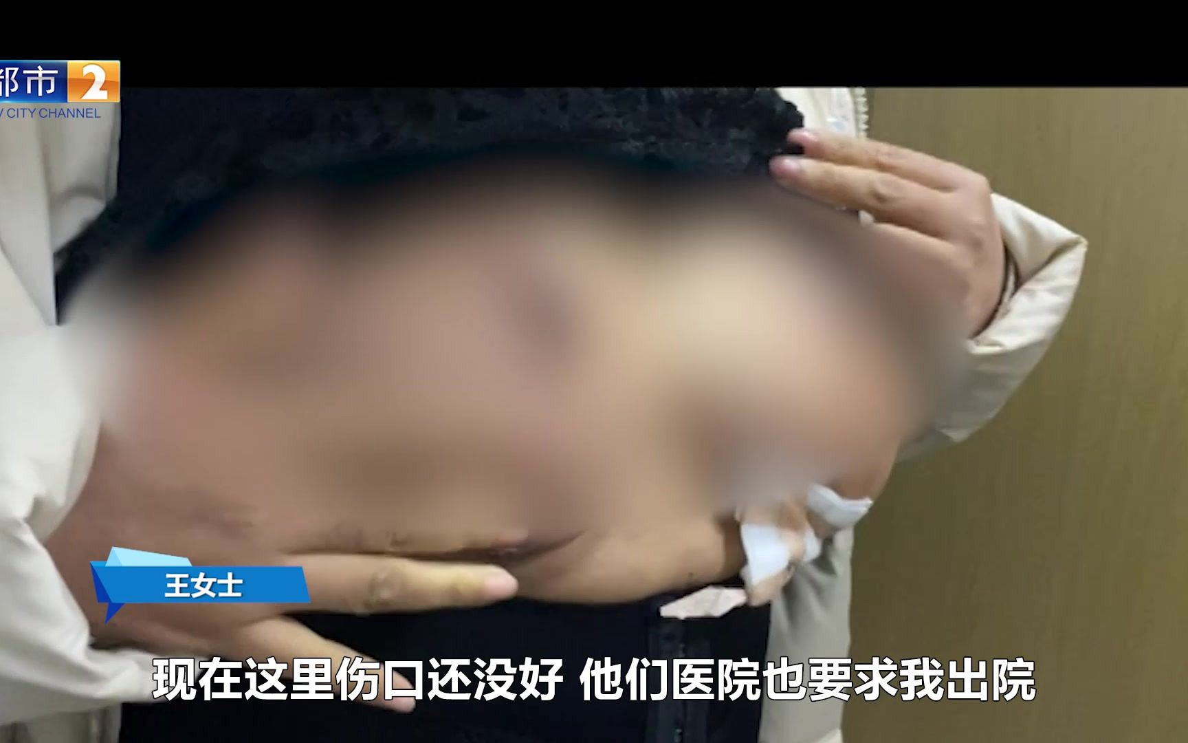 [图]女子嫌胸太大做缩胸术 皮肤坏死难治愈 被院方讽刺“是个无底洞”