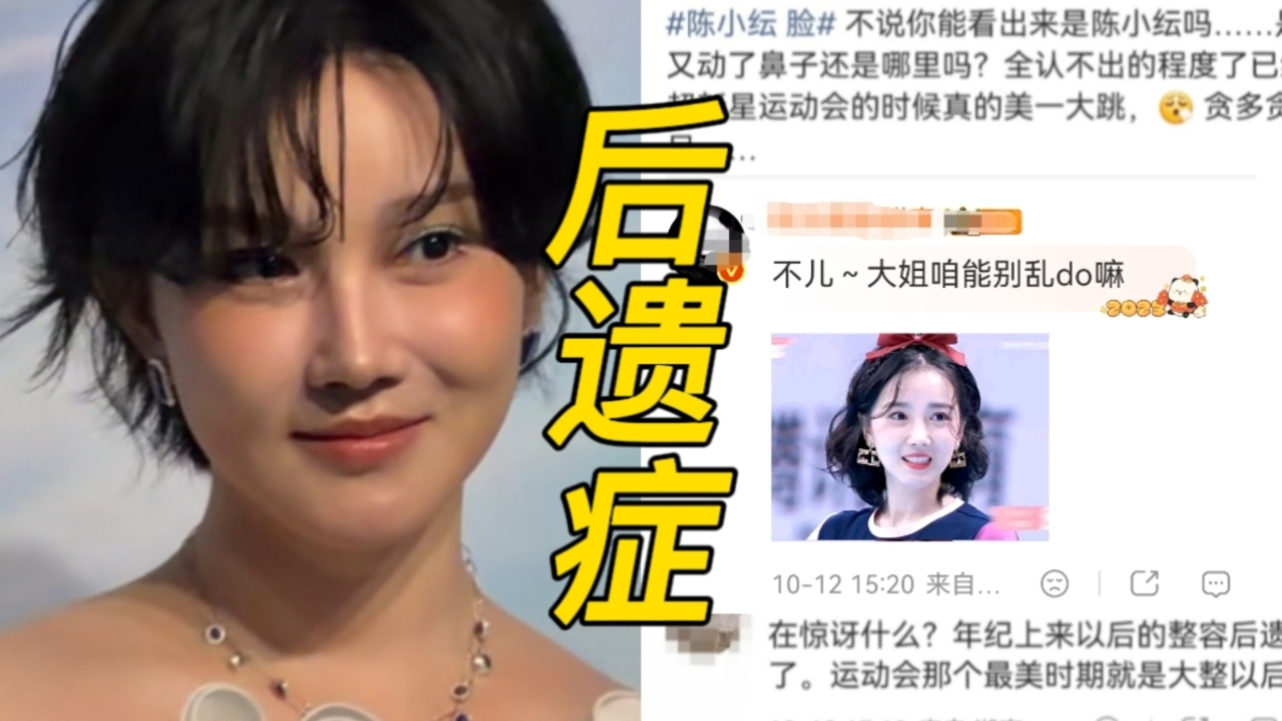 陈小纭do脸翻车了，最新活动生图流出，面部被网友吐槽苹果肌饱满突出，馒化、发面感明显，网友都在说是年纪大了，do脸后遗症来了！