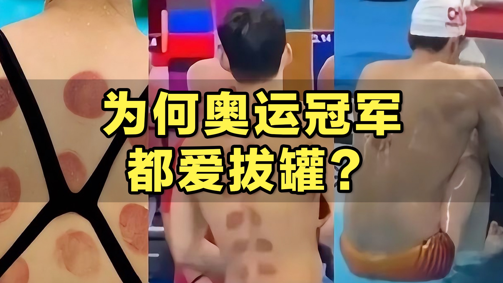 东方秘术:拔罐的原理是啥?哔哩哔哩bilibili