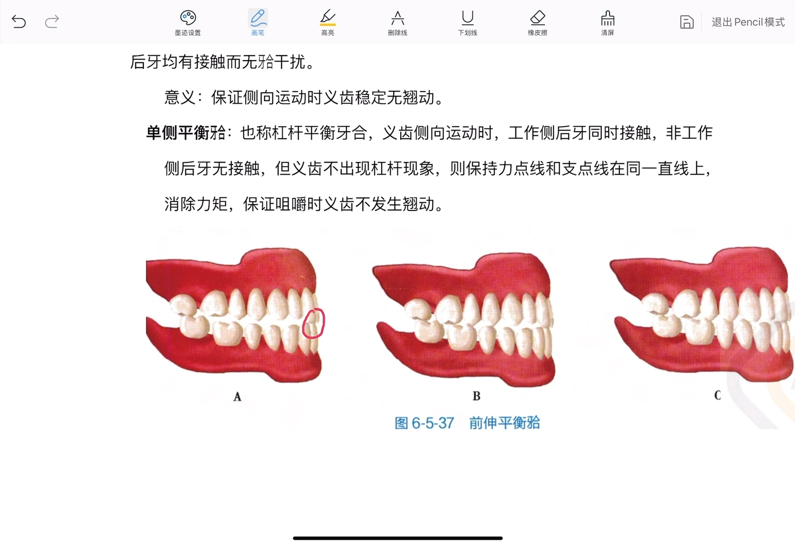 顶颌位的图解图片