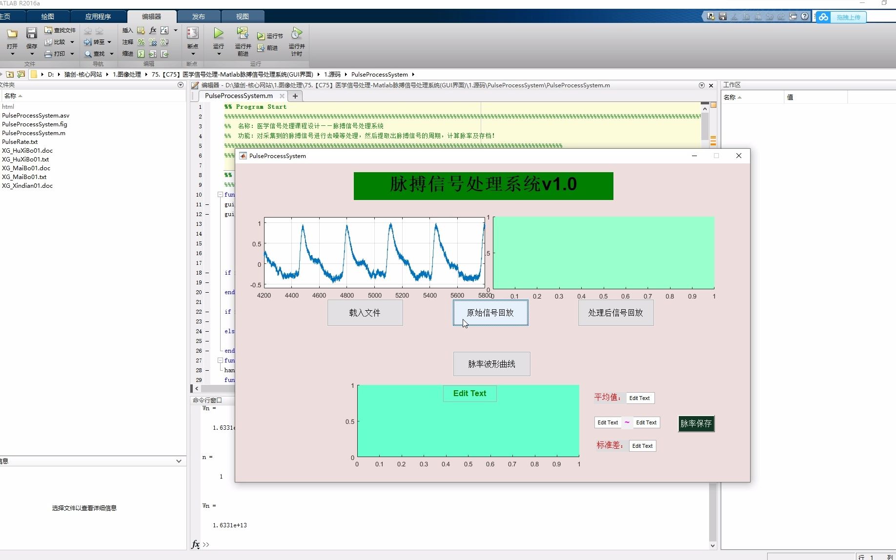 [图]医学信号处理-Matlab脉搏信号处理系统(GUI界面)