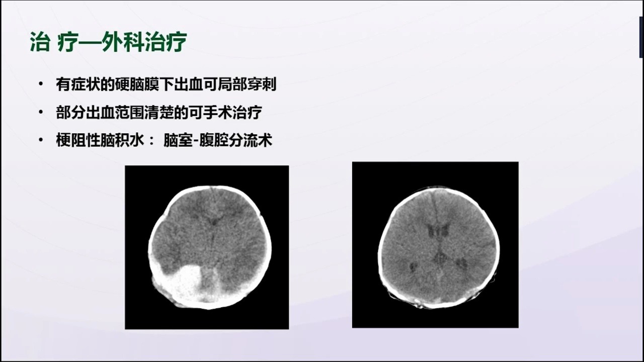 新生儿颅内出血彭小明哔哩哔哩bilibili