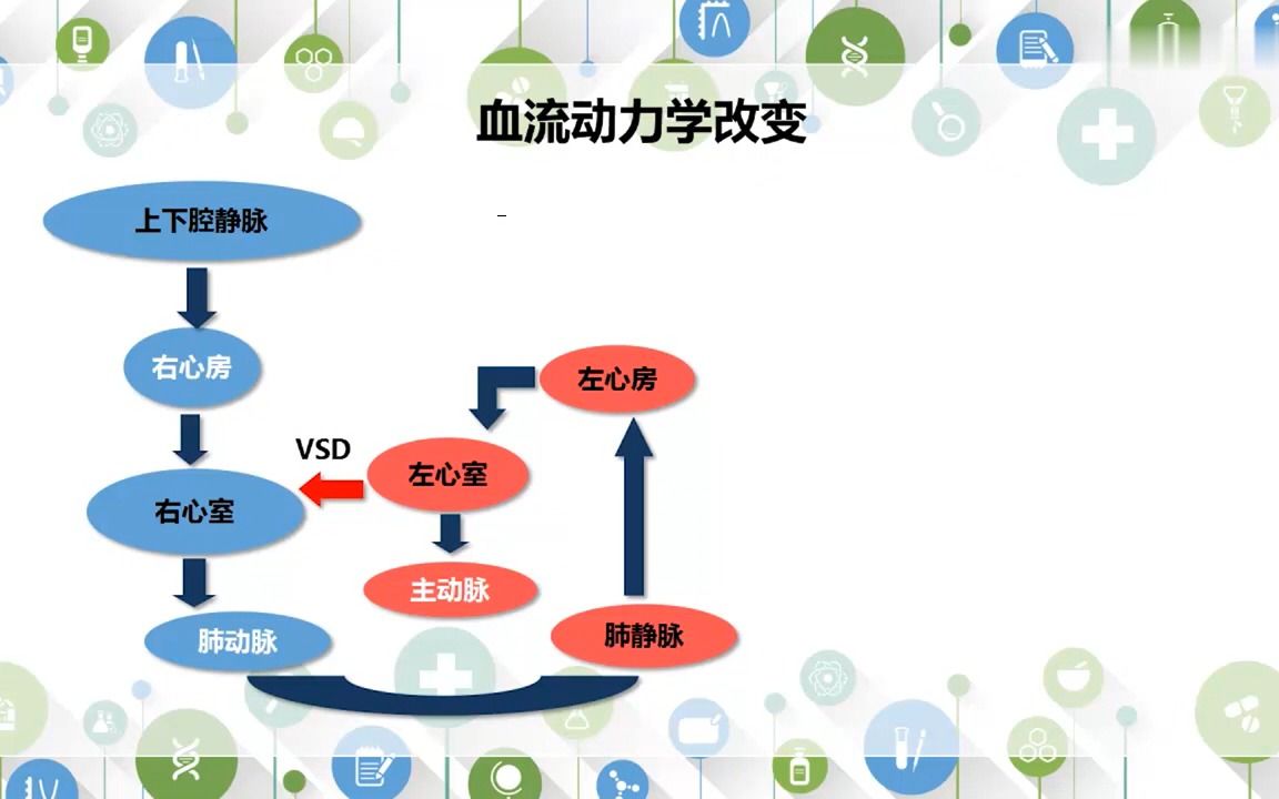 7.3.3 室间隔缺损哔哩哔哩bilibili