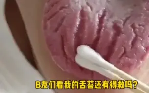 Tải video: B友们看我的舌苔还有的救吗？