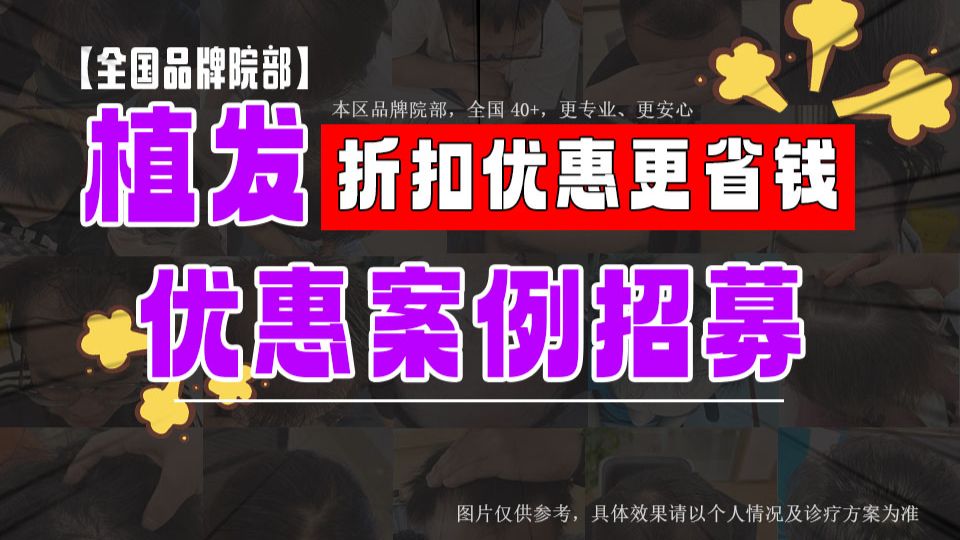 植发技术革新！当天告别秃额头，头顶稀疏【品牌植发】