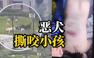 Download Video: 四川崇州一小区内恶犬撕咬小孩长达一分多钟，大人拼命阻挡