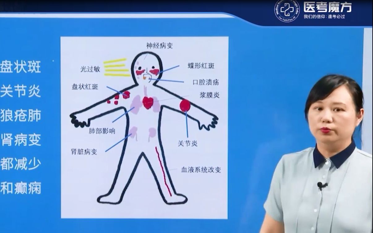 临床医师风湿免疫性疾病系统性红斑狼疮的临床表现速记口诀