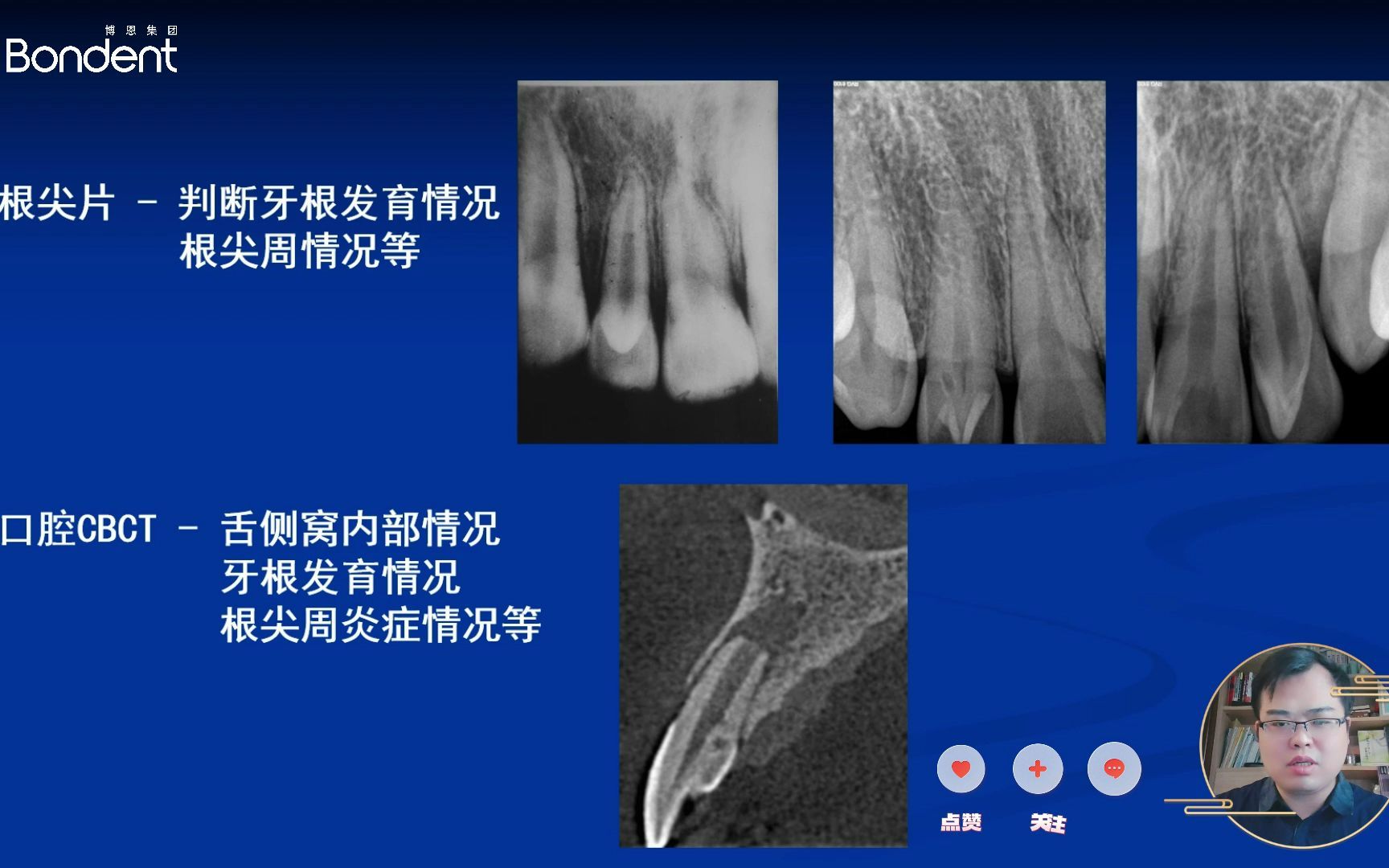 畸形舌侧窝图片图片