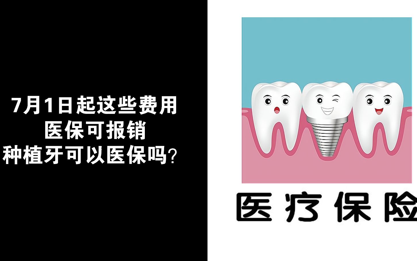 7月1日起这些费用医保可报销,种植牙可以医保吗?哔哩哔哩bilibili