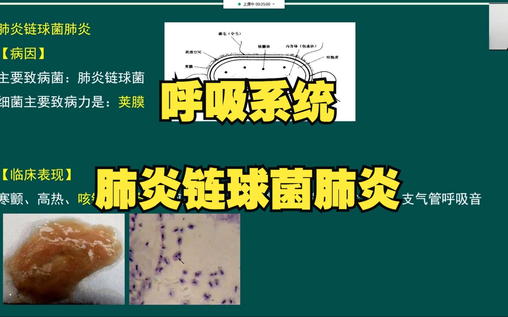 懒人医考盛玲老师精讲:呼吸系统