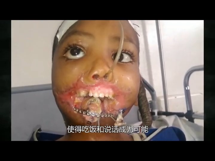 奇特的小孩 #大象男孩 #大头女孩 #怪异的小孩