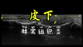 Download Video: 皮下蜂窝组织炎