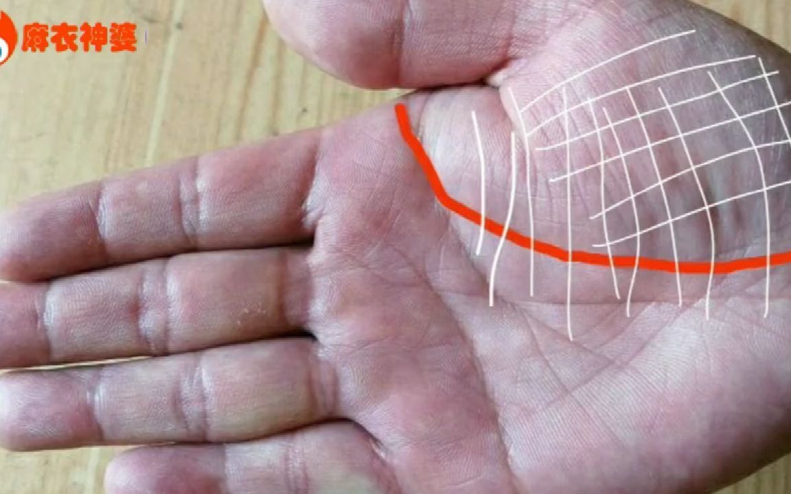 金星丘有烦恼线的人,容易思虑过多,爱操心,生活上比较辛劳,生活中多