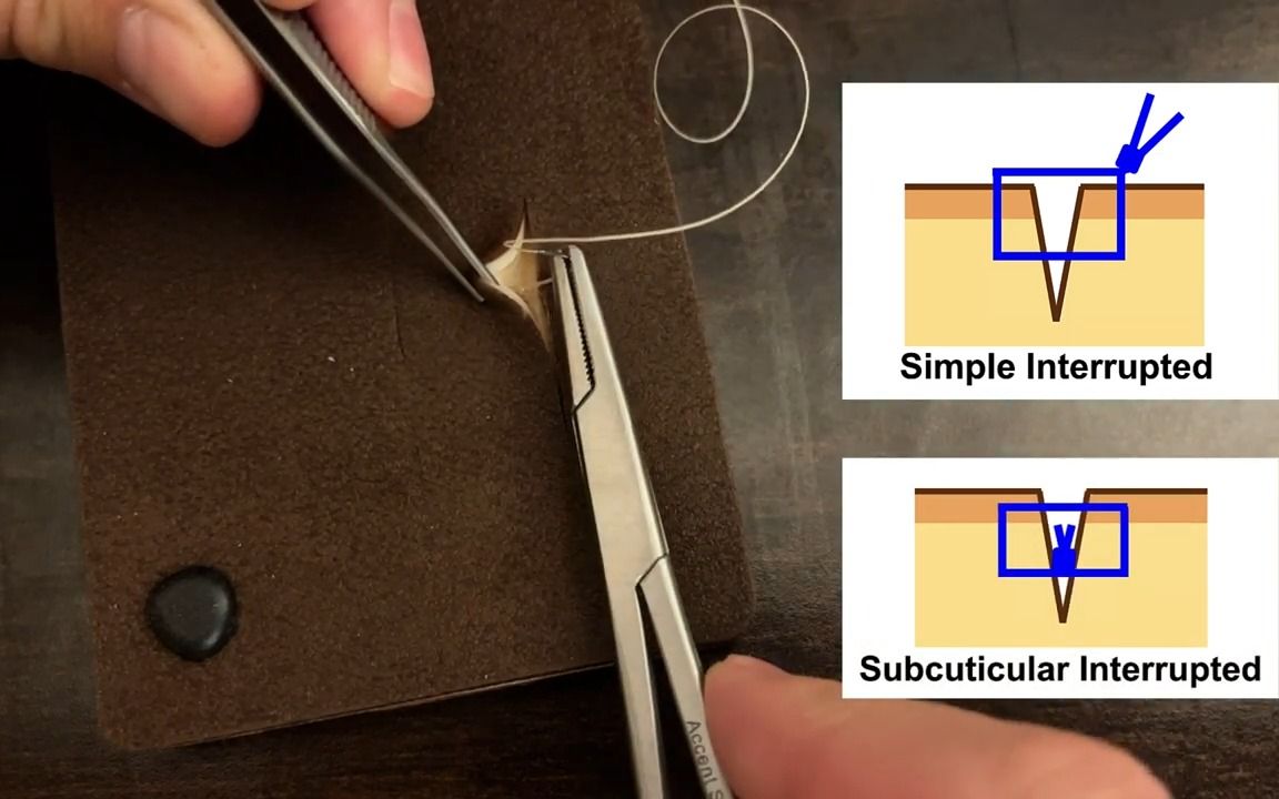 【缝合技巧】【皮下间断缝合】SUTURE Tutorial:Subcuticular Interrupted Suture哔哩哔哩bilibili