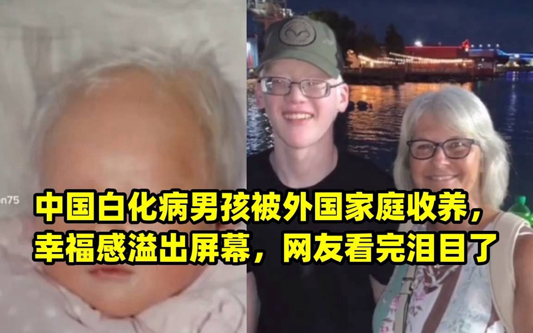 中国白化病男孩被外国家庭收养,幸福感溢出屏幕,网友看完泪目了