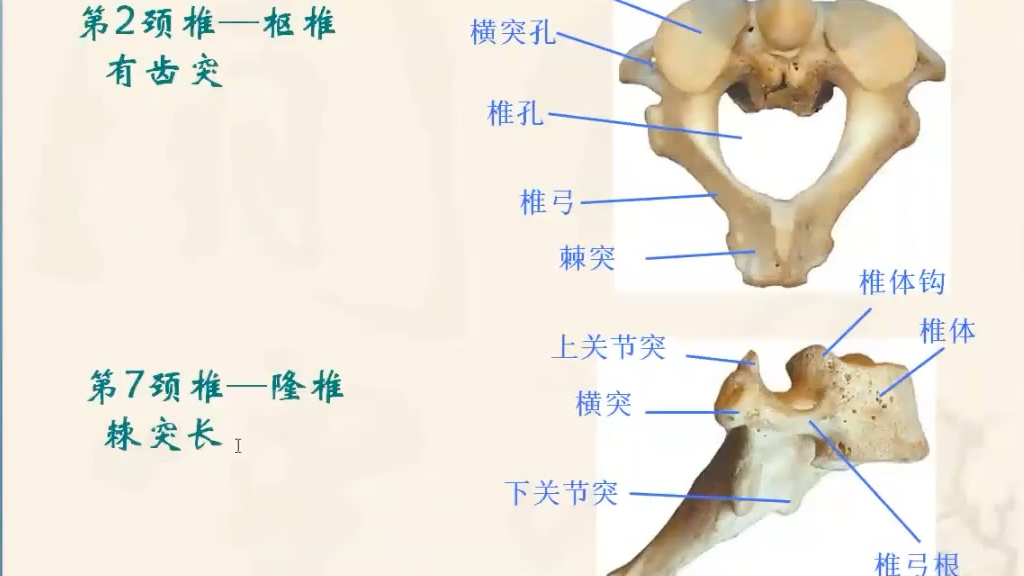 运动解剖学—寰椎、枢椎,隆椎,比之前的瑜伽解剖学可能更加精细,更深入,专业医学教授的授课,希望能帮助到您.哔哩哔哩bilibili