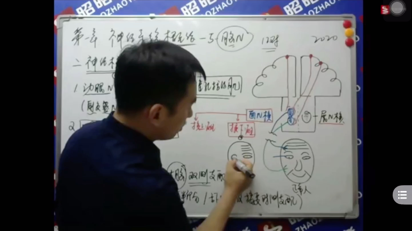 【执医知识碎片】面神经核单双侧支配,周围性面瘫(核下瘫)及中枢性面瘫(核上瘫)的详细讲解哔哩哔哩bilibili