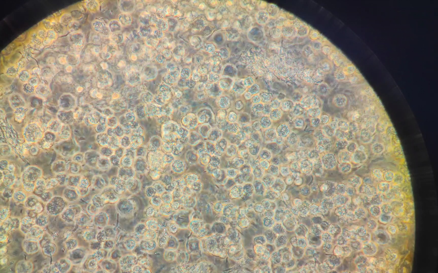 显微镜下活泼可爱的杆菌们