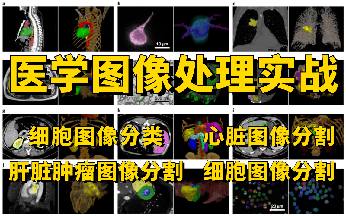 细胞图像分类、肝脏肿瘤图像分割、心脏图像分割、细胞图像分割全详解,这绝对是你见过最全面的医学图像分割实战教程!究极通俗易懂!哔哩哔哩bilibili