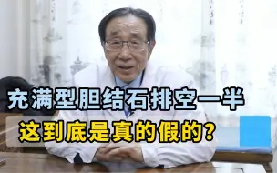 Download Video: 充满型胆结石排空一半，这到底是真的假的？